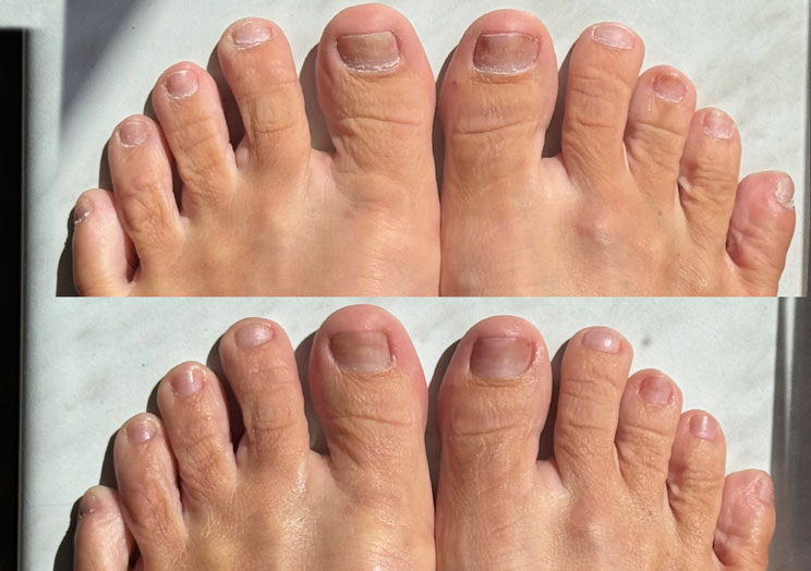 Žanetiny prsty – jemnější, hydratované výsledky po použití MOLOSOC